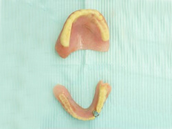 入れ歯の修整1