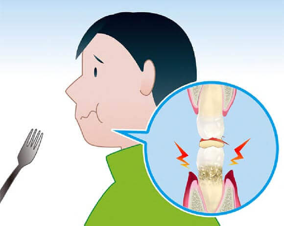 食事時の痛み