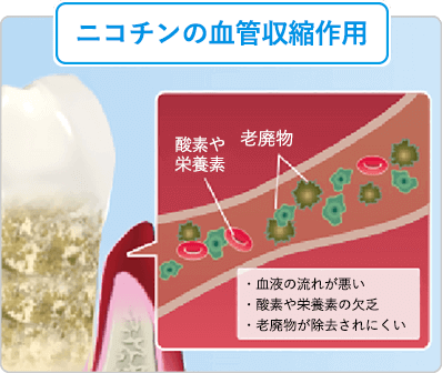 ニコチンの血管収縮作用